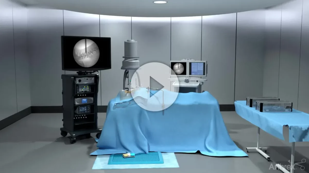 Endoscopic Foraminotomy